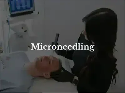 Microneedling 01 (1) Microneedling 01 (1)